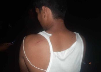 कैलालीको टीकापुरमा एकै व्यक्ति माथि दुई/दुई पटक खुकुरी प्रहार हुदा समेत प्रहरी मुख दर्शक