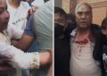 जेनजी आन्दोलनमा पूर्वप्रधानमन्त्री देउवा र पत्नी कुटिए